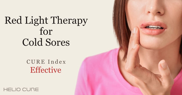 Red light therapy for cold sores