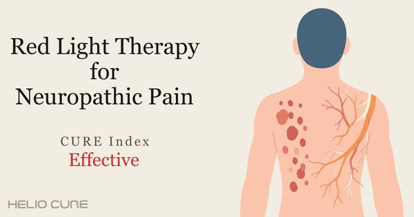 Red light therapy for neuropathic pain