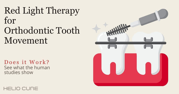 Red light therapy for orthodontic tooth movement