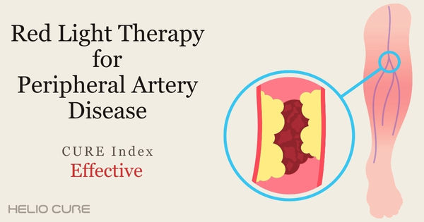Red light therapy for peripheral artery disease