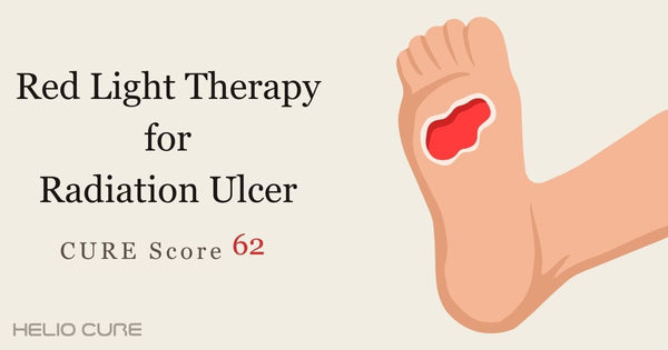 Red light therapy for radiation ulcer