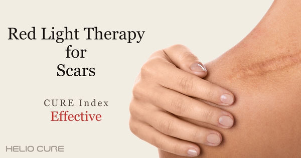 Red light therapy for scars