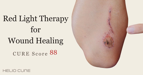 Red light therapy for wound healing