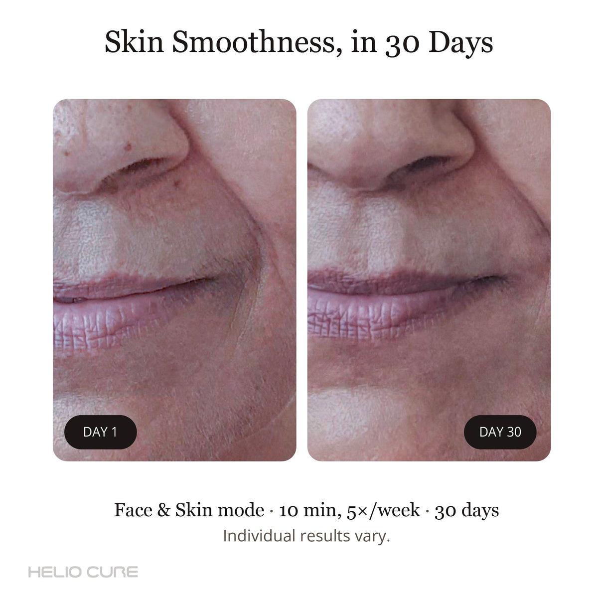 Helio Cure Results