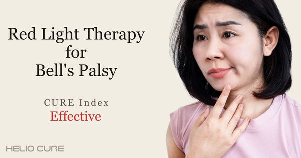Red light therapy for Bell's palsy