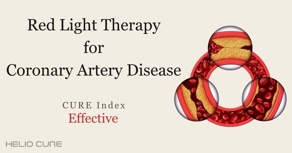 Red light therapy for coronary artery disease