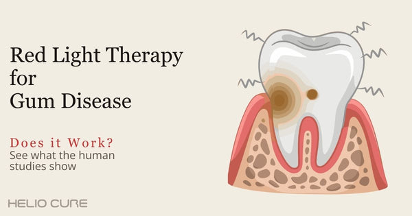 Red light therapy for gum disease
