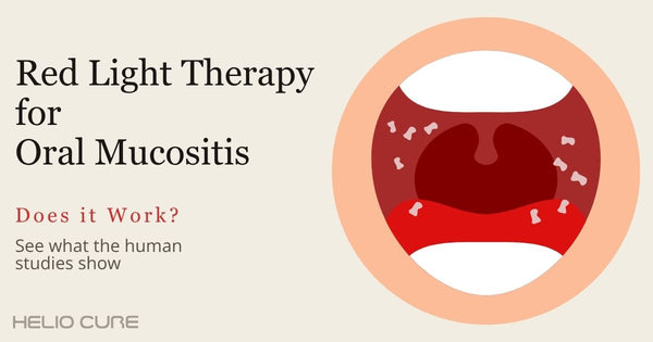 Red light therapy for oral mucositis