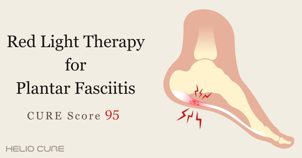 Red light therapy for plantar fasciitis