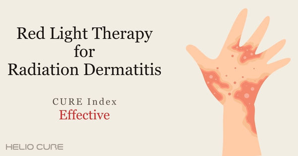 Red light therapy for radiation dermatitis