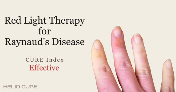 Red light therapy for Raynaud's disease
