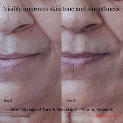 Before and After Skin Results
